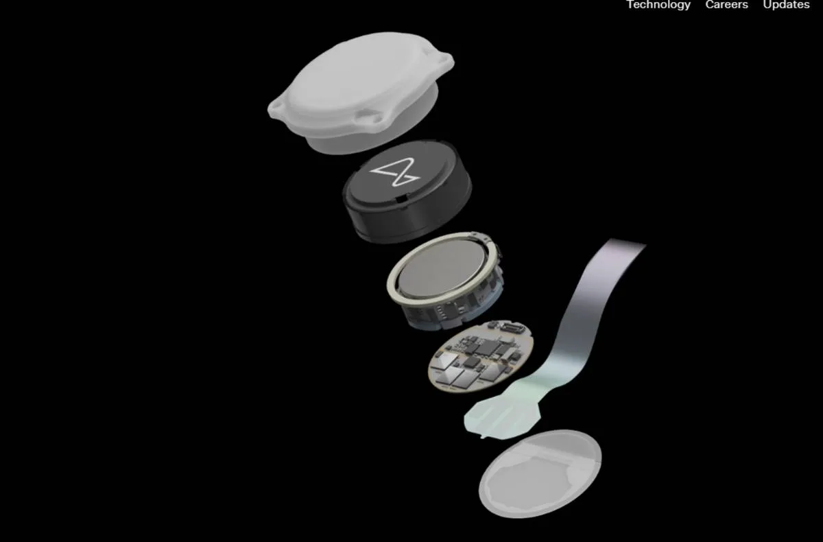 Neuralink impacts medical technology! Musk aims to implant 20,000 brain chips annually by 2031