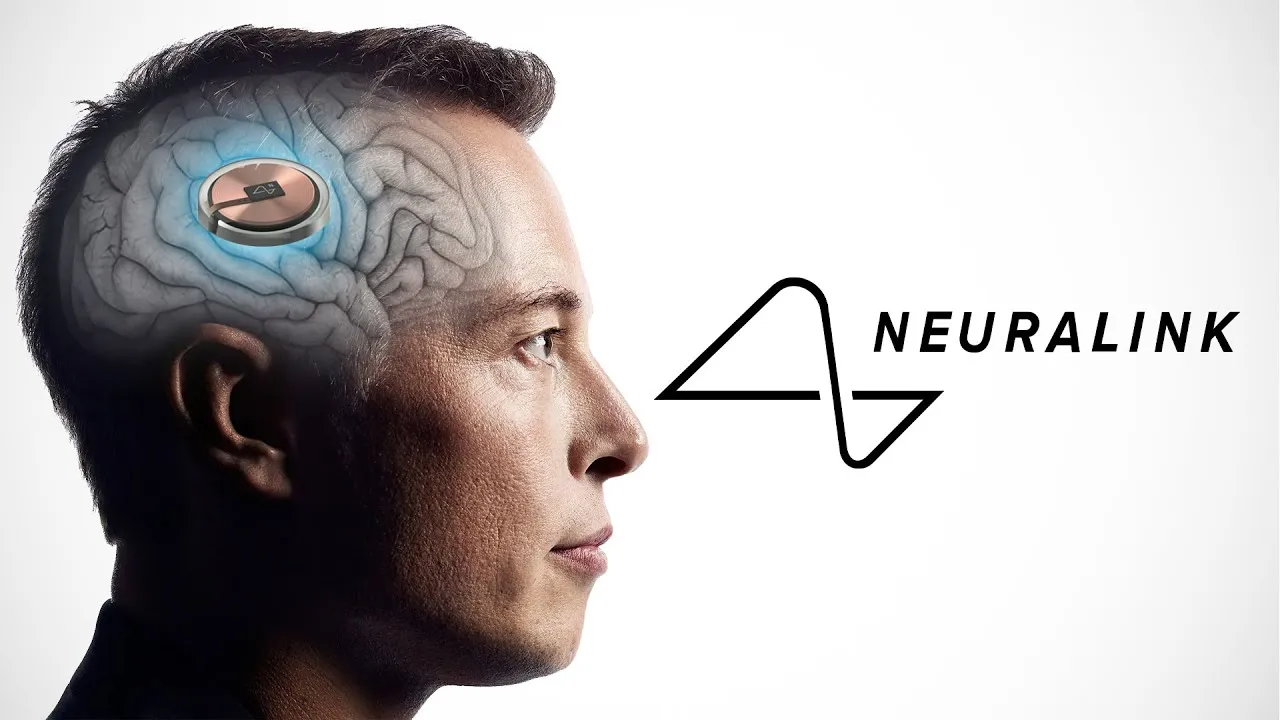 Neuralink impacts medical technology! Musk aims to implant 20,000 brain chips annually by 2031
